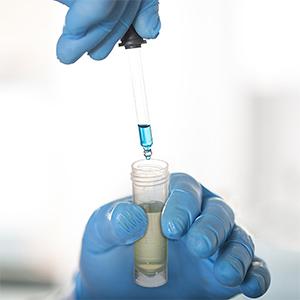 Ensemble de 100 tubes à essai en plastique avec couvercles, tubes à injection graduée de 5 ml avec capuchons à vis Petits flacons Contenant pour liquide 4