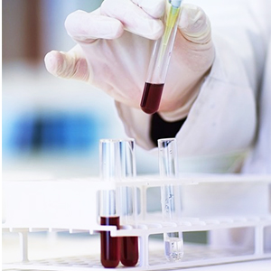 Tubes d'essai en plastique avec support et bouchons, 16 x 100 mm avec support pour expériences scientifiques, perles liquides 2