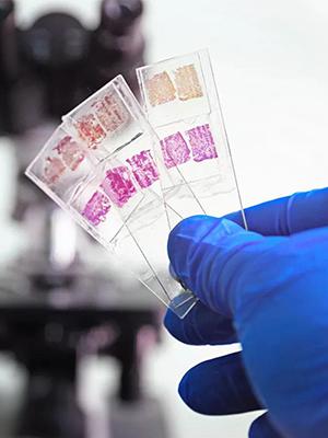 Slides et couvertures pour microscope, diapositives en verre vierge pour microscope - 300 diapositives, 300 couvertures, pour microscopie 1