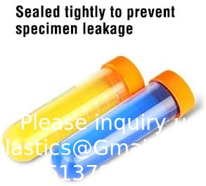 SCIENCE LAB Science primaire Jumbo tubes à essai avec support, ensemble de 10 tubes, ustensiles en plastique de laboratoire, tube de laboratoire pour les tests